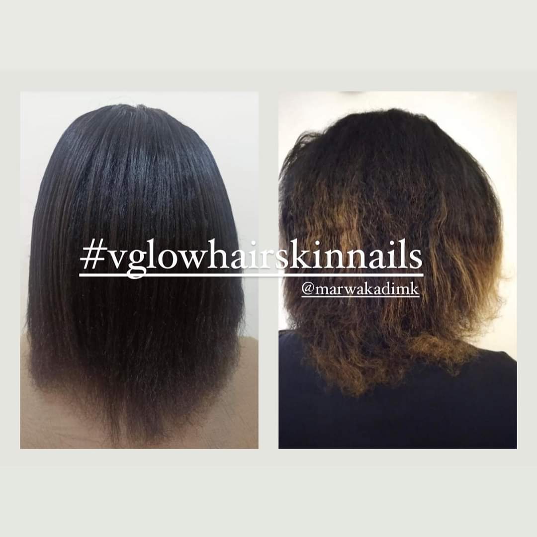 hair skin and nails vitamins before and after